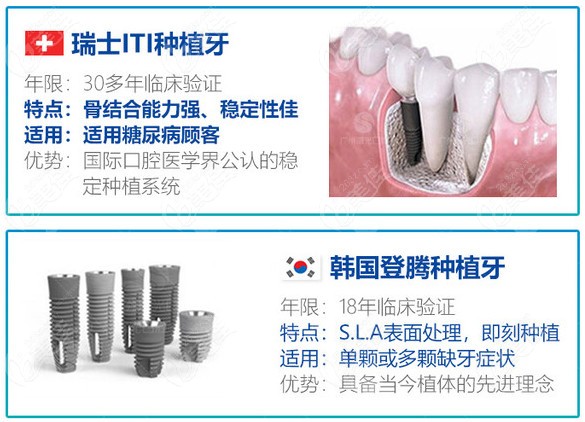 瑞士ITI与韩国登腾种植牙的优势