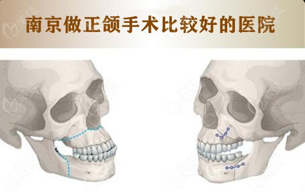 南京做正颌比较好的医院名单