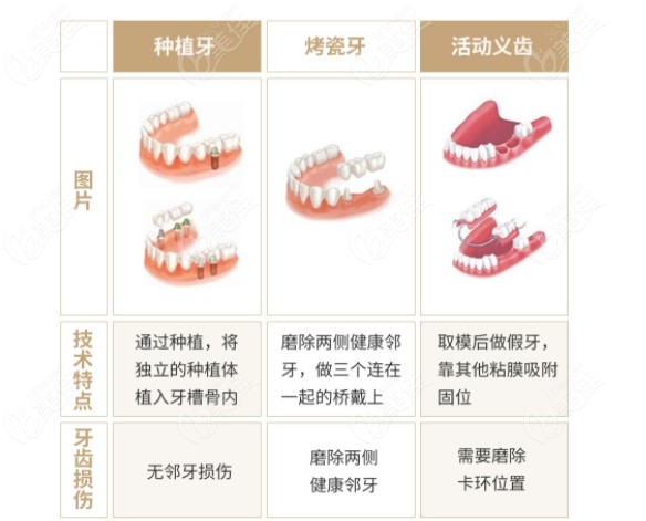 种植牙和义齿的区别