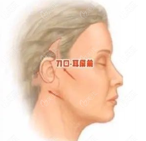 迷你mini小拉皮怎么做
