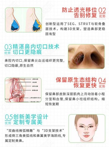 銀川做鼻子好的醫生都是推薦個做膨體鼻綜合比較好的醫生