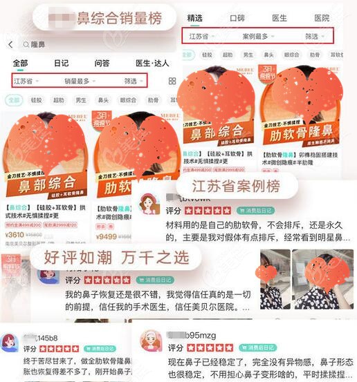 南京美贝尔隆鼻的口碑评价