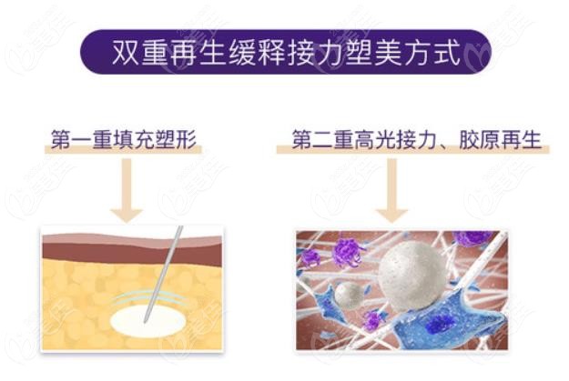 濡白天使针双重再生方式维持时间更持久