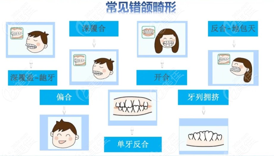 jpf肌功能矫治器成效好不好?和mrc的区别不止价格和型号哦