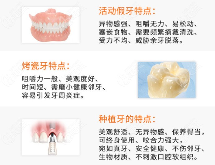 活动假牙、烤瓷牙、种植牙的特点和区别