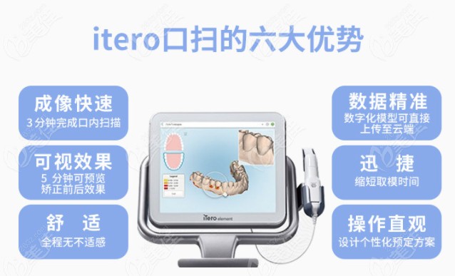 杭州上扬口腔itero矫正黑科技口扫设备的优势