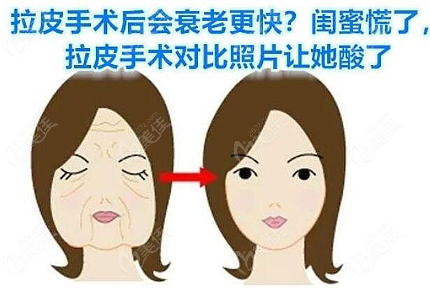 北京加减美面部提升术前术后对比图