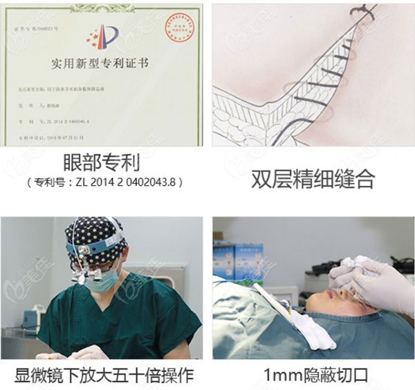 王小林医生做的内切去眼袋技术