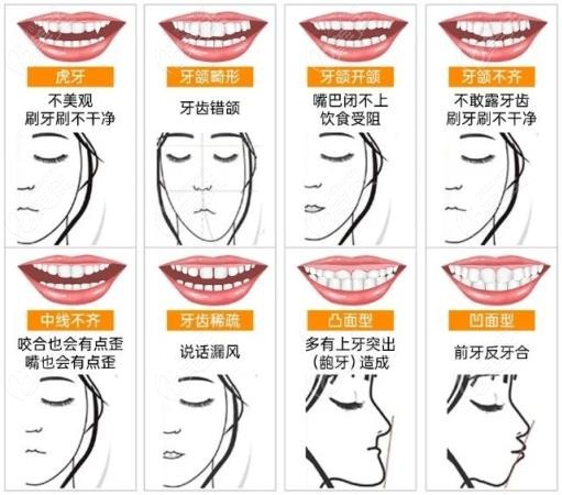 壹顆牙口腔特色項(xiàng)目——正畸