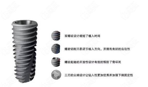 韩国登腾二代植体