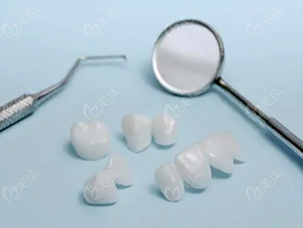 全瓷牙冠修复牙齿缺损问题