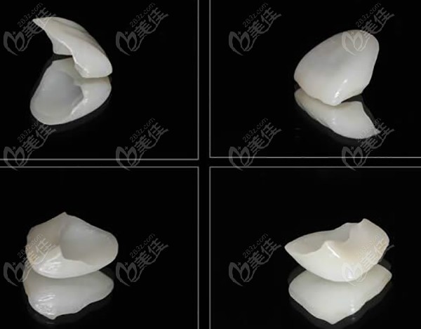 全瓷牙冠可以修补的牙齿损伤