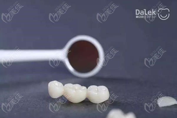 国产戴立克二氧化锆全瓷牙