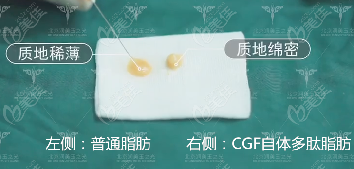 CGF脂肪比纳米脂肪密度更高