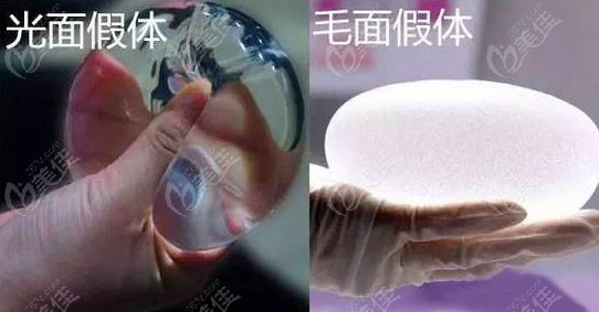 曼托假体隆胸光面和毛面手感区别大吗