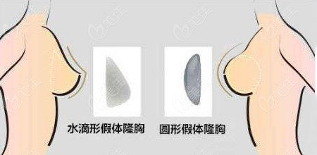 形态对比曼托毛面和光面的利弊