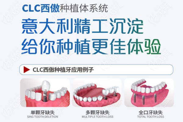 意大利西傲种植体系统