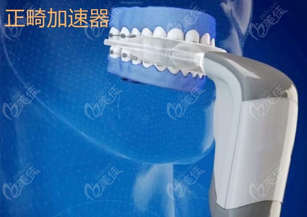 正畸加速器有必要买吗