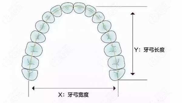 弓吧,牙弓就是在牙床上,牙齿按照一定的方向,位置和顺序排列成的弓形