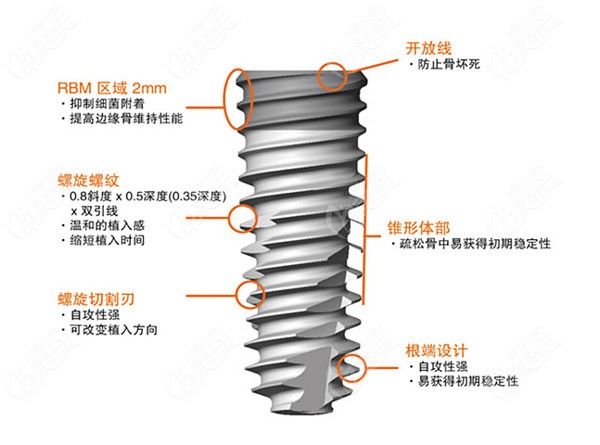 韩国奥齿泰螺旋设计