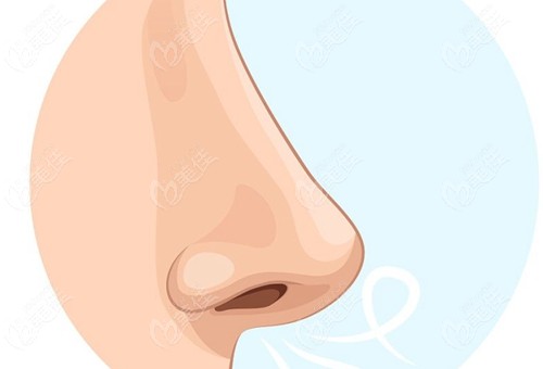 耳软骨+膨体隆鼻鼻尖硬