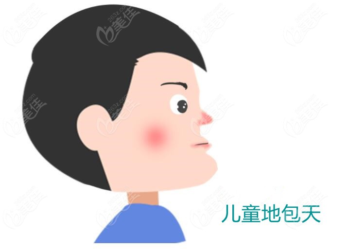 儿童地包天症状