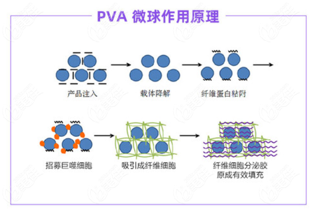 宝尼达玻尿酸微球作用原理图解