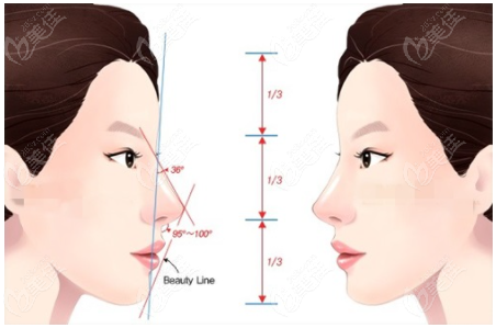 假体隆鼻标准参照图