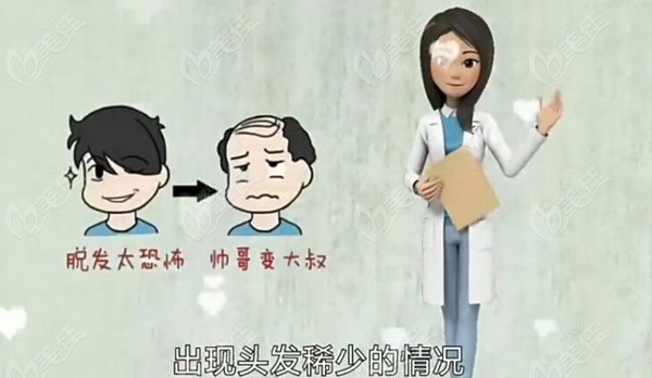 38岁男人头顶没头发怎么办