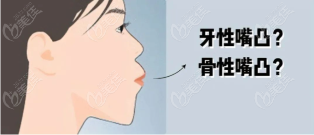 骨性嘴凸做牙齿矫正能够改善好吗？