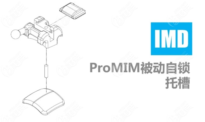 埃蒙迪系列被动自锁托槽