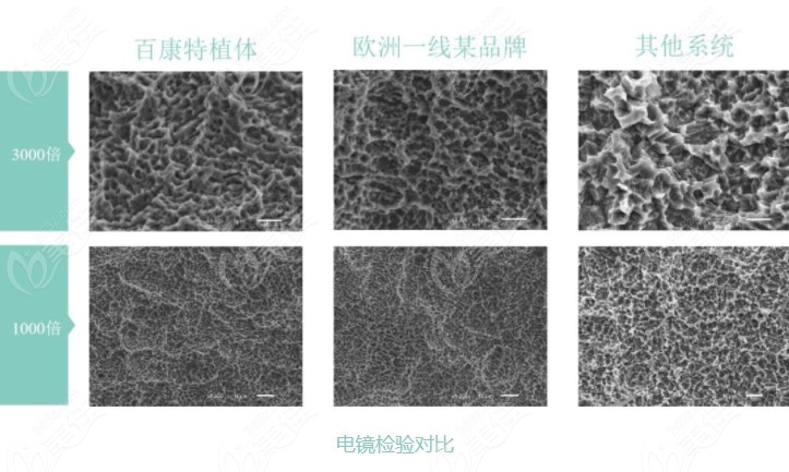 牙本质电镜图图片