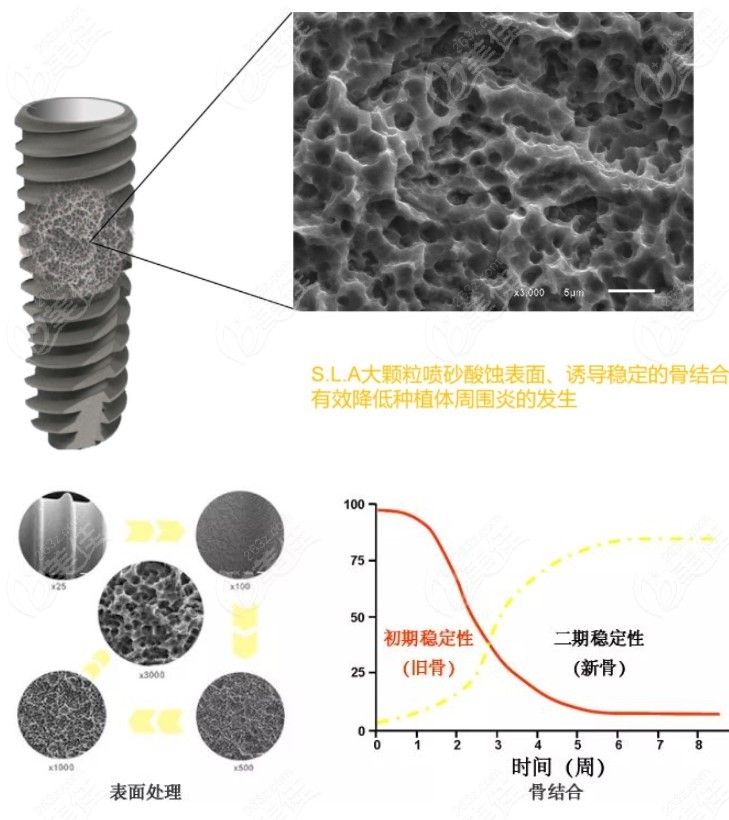 百康特表面处理和骨结合情况