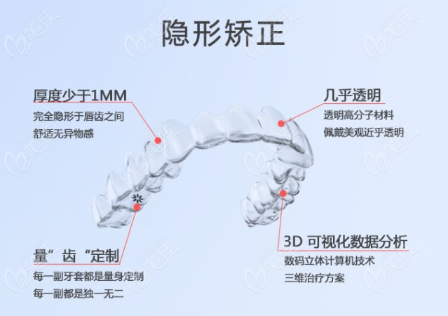 隐形牙齿矫正器的优点了解下