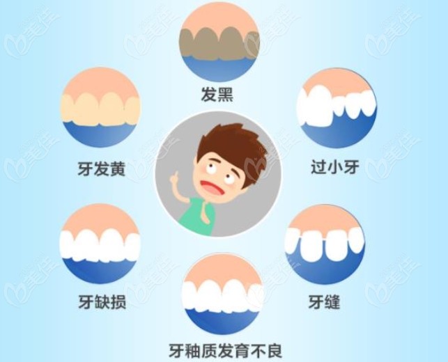 牙贴面的适应症