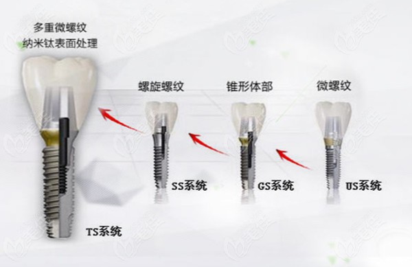 韩国奥齿泰种植体型号及适应症