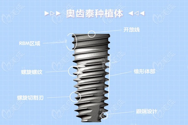 韩国奥齿泰种植体工艺设计
