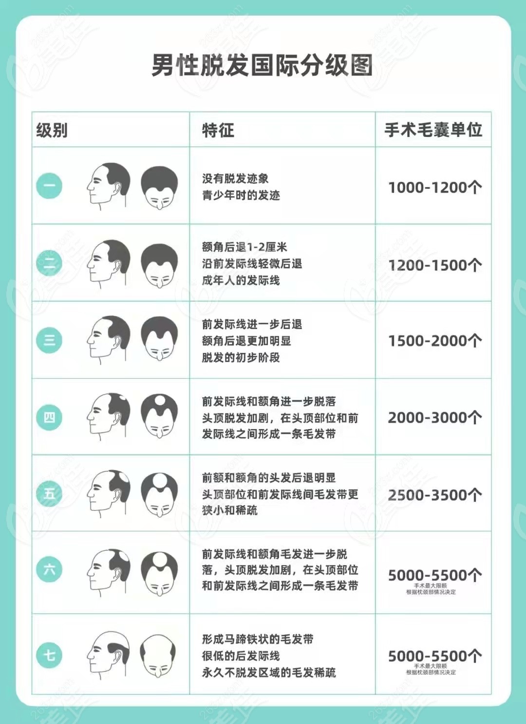 不同植发技术价格略有不同,这里