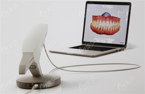 牙齿矫正3shape口腔扫描