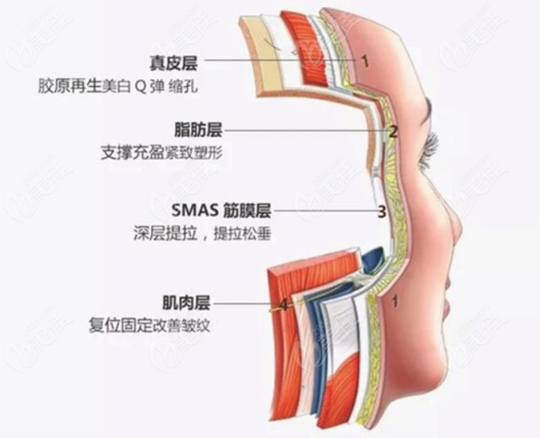 拉皮手术作用是拉的筋膜层还是皮肤层