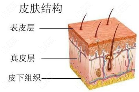速提美提升示意图