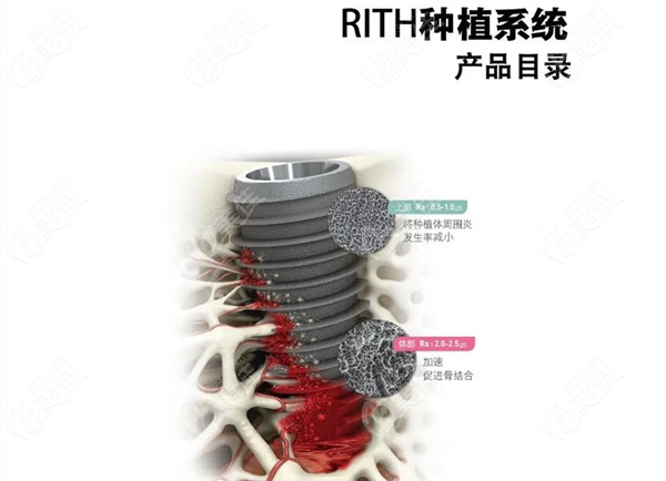 韩国RITH种植系统