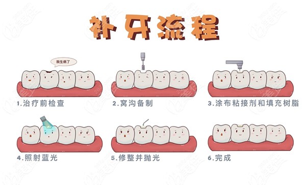 树脂补牙的流程图