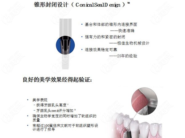 瑞典astra种植系统介绍