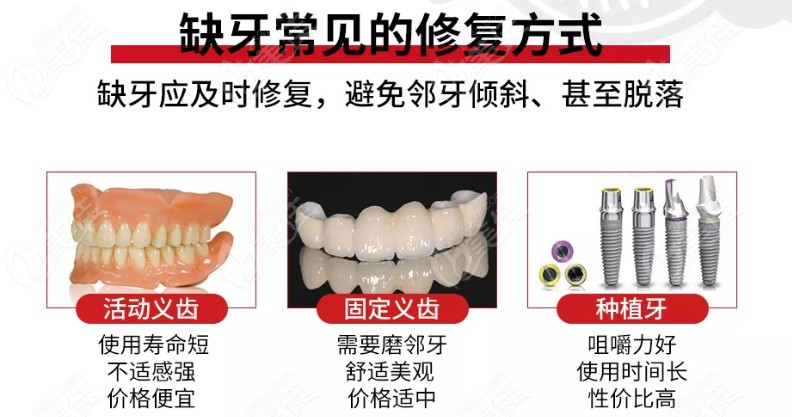 缺牙的3种修复方式