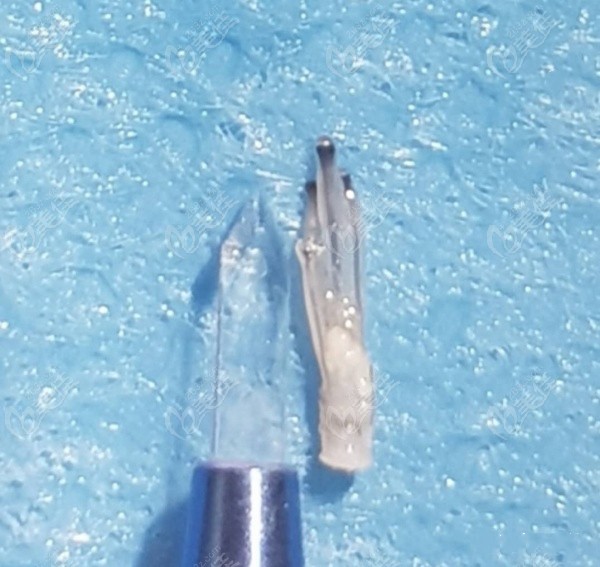 宝石刀和毛囊的大小差不多