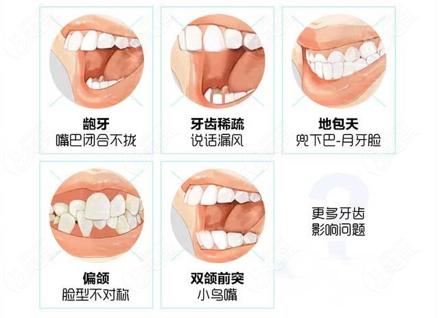 牙齿矫正可改善的情况如图