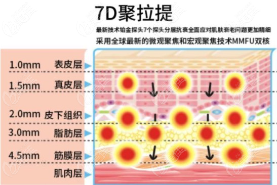 7D聚拉提作用层示意图