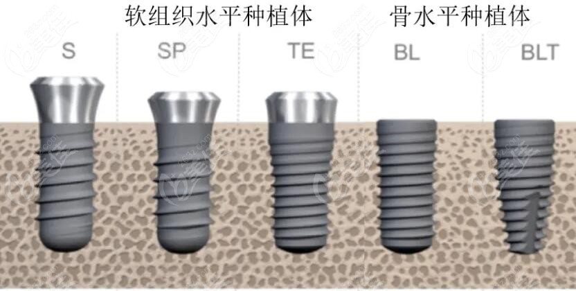 士卓曼种植体的外观形态