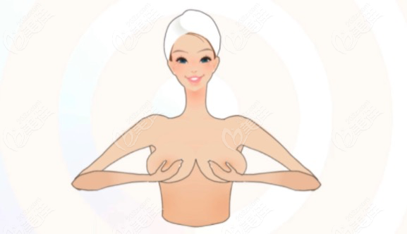 假体隆胸做完之后按摩方式